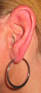 ear piercing - lobe piercing